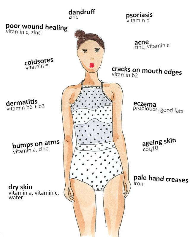 Acne Body Chart